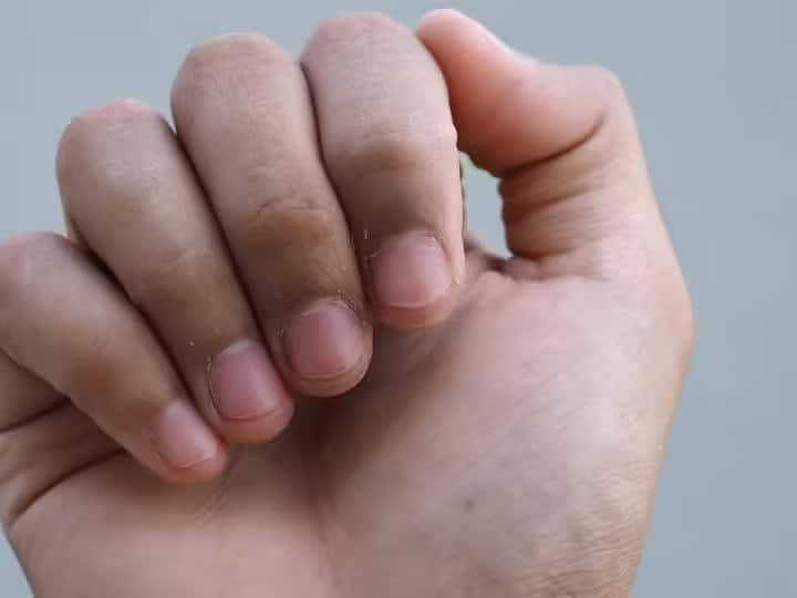 Use alum to remove blackness of fingers you will get amazing benefits उंगलियों के कालेपन से होती है शर्मिंदगी तो फिटकरी के इस्तेमाल से रंगत सुधारें... ऐसे करें इस्तेमाल