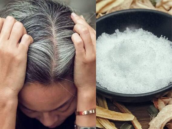Take care of your skin and hair, then use coconut oil Alum Coconut Oil For Hair: જો તમારા વાળ સફેદ થઈ રહ્યા છે તો ફટકડી અને નારિયેળ તેલનો કરો ઉપયોગ, થશે અઢળક ફાયદા