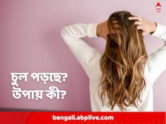 অনবরত ঝরছে চুল? বাঁচাবে রান্নাঘরের এই আনাজ