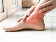 बढ़ा हुआ है यूरिक एसिड तो गलती से भी ना खाएं ये सब्जी, नहीं तो पड़ जाएंगे लेने के देने