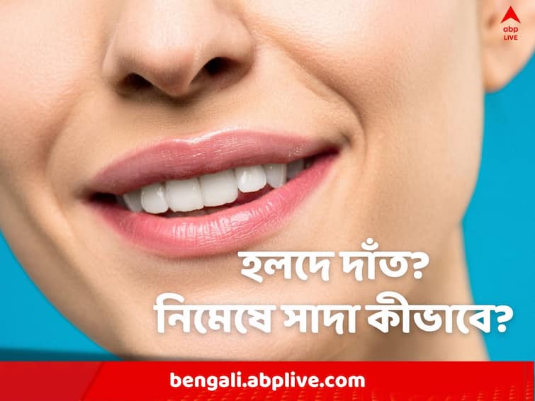 How to whiten teeth at home, get rid of yellow teeth with home remedies, know in details White Teeth: হলুদ হচ্ছে দাঁত? সাদা রং ফেরাতে ভরসা ঘরোয়া টোটকা