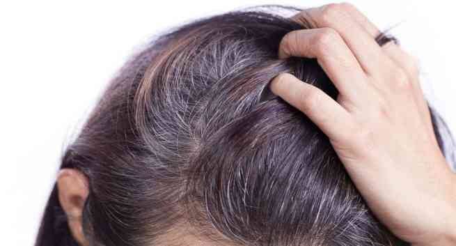 Hair care: Can grey hair turn black again naturally? Hair Tips: નાની ઉંમરે વાળ થઈ રહ્યા છે સફેદ, તો અપનાવો આ આયુર્વેદિક નુસખો, સફેદ વાળ થશે કાળા