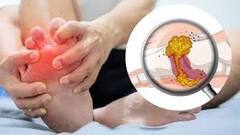 Uric Acid And Vegitables : ਯੂਰਿਕ ਐਸਿਡ ਵਧਣ 'ਤੇ ਨਾ ਖਾਓ ਇਹ ਸਬਜ਼ੀਆਂ, ਹੋ ਸਕਦੀ ਸਮੱਸਿਆ