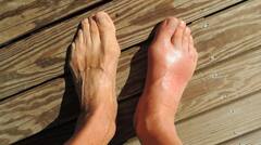 Uric Acid And Vegitables : ਯੂਰਿਕ ਐਸਿਡ ਵਧਣ 'ਤੇ ਨਾ ਖਾਓ ਇਹ ਸਬਜ਼ੀਆਂ, ਹੋ ਸਕਦੀ ਸਮੱਸਿਆ