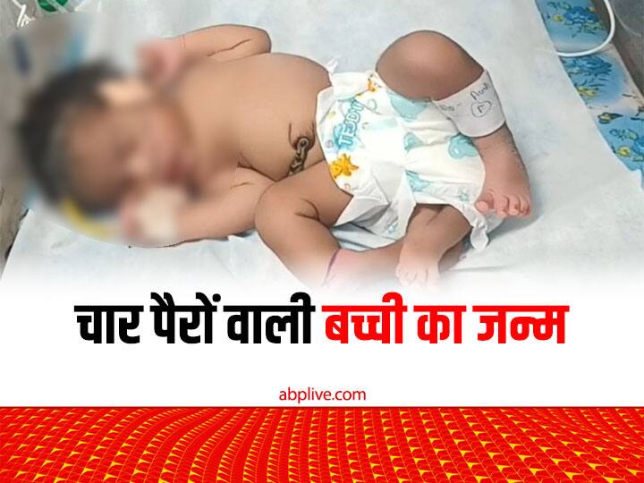 Gwalior News Woman gave birth to a 4-legged baby girl in Madhya Pradesh crowd gathered to see Doctors reveals Why ann Gwalior News: महिला ने दिया 4 पैरों वाली बच्ची को जन्म, डॉक्टर्स ने बताई इस अजूबे की वजह