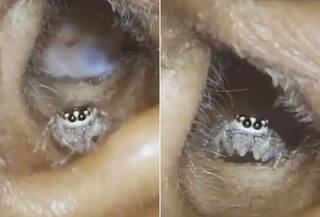 Shocking Video: ਔਰਤ ਦੇ ਕੰਨ ਦੇ ਅੰਦਰ ਜਾ ਪਹੁੰਚੀ ਮੱਕੜੀ, ਡਰਾਉਣੀ ਵੀਡੀਓ ਦੇਖ ਕੇ ਕੰਬ ਜਾਏਗੀ ਰੂਹ!