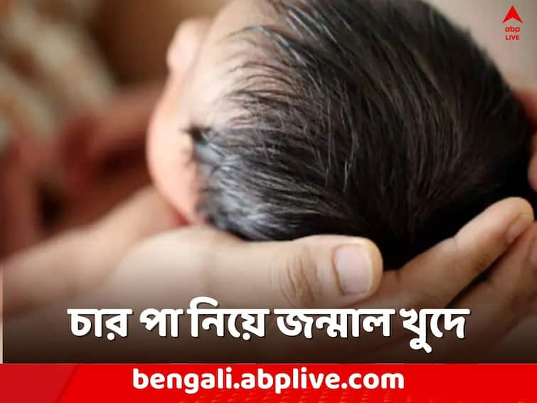 Woman Gives Birth To Baby Girl With Four Legs In Madhya Pradesh Creating Hue And Cry Viral News: চার পা নিয়ে জন্মাল খুদে! মধ্যপ্রদেশের গ্বালিয়রের ঘটনায় সাড়া