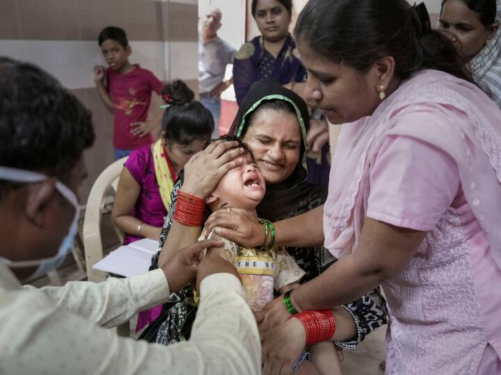 MEHSANA 91 measles suspected cases detected Samples were sent to Ahmedabad Gujarat Measles Cases: अलर्ट! गुजरात के इन इलाकों में खसरे का प्रकोप, सामने आए 91 संदिग्ध मामले