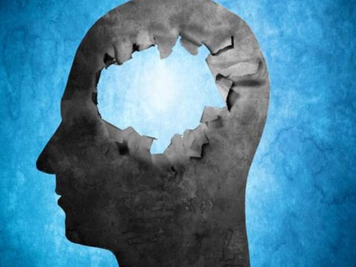 Why are women more likely to develop Alzheimer disease महिलाओं में तेजी से बढ रही है ये गंभीर बीमारी, समय रहते लक्षण पहचान लीजिए नहीं तो जा सकती है जान