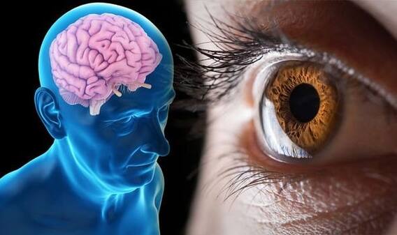Alzheimer's disease: Alzheimer's disease is increasing in women more than men, know the treatment Alzheimer's disease: Alzheimer's disease is increasing in women more than men, know the treatment