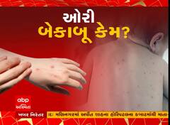 રાજ્યમાં ઓરીનો આતંક, 9 બાળકોએ જીવ ગુમાવ્યા, એક મહિનામાં 1650 કેસ નોંધાયા