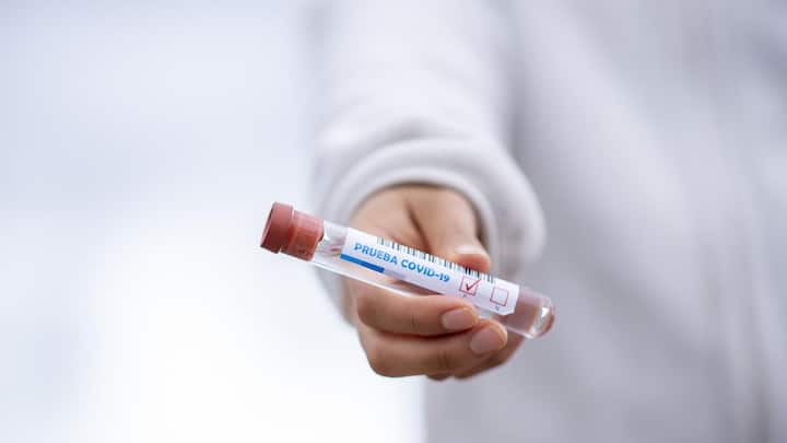 এই পরিস্থিতিতে স্বাস্থ্য সচিবের উপস্থিতিতে আজ স্বাস্থ্য ভবনে বৈঠকে বসছে কোভিড পরামর্শদাতা কমিটি। রাজ্যের কোভিড পরিস্থিতি কেমন, সংক্রমণ বাড়লে তা মোকাবিলা করার কী ব্যবস্থা রয়েছে, তা নিয়েই মূলত আলোচনা হবে। 