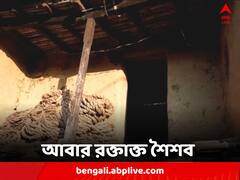 বোমা ফেটে ঝলসে গেল শরীর, ৮ বছরের ২ শিশু গুরুতর জখম বীরভূমে, পঞ্চায়েত ভোটের আগে ফের বারুদের আস্ফালনে চিন্তা