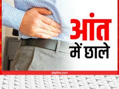 सौंठ से लेकर छाछ तक...आंतों में न्यूट्रिऐंट्स सोखने की क्षमता बढ़ाते हैं ये 5 फूड्स