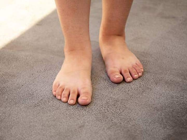 Why Does Type 2 Diabetes Cause Your Feet To Go Numb