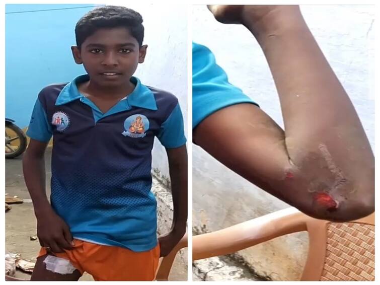 Tenkasi: 2 students injured in wild boar attack near Kadayam TNN கடையம் அருகே காட்டுப்பன்றி தாக்கி 2 மாணவர்கள் படுகாயம் -  அச்சத்தில் பொதுமக்கள்