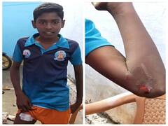 கடையம் அருகே காட்டுப்பன்றி தாக்கி 2 மாணவர்கள் படுகாயம் - அச்சத்தில் பொதுமக்கள்