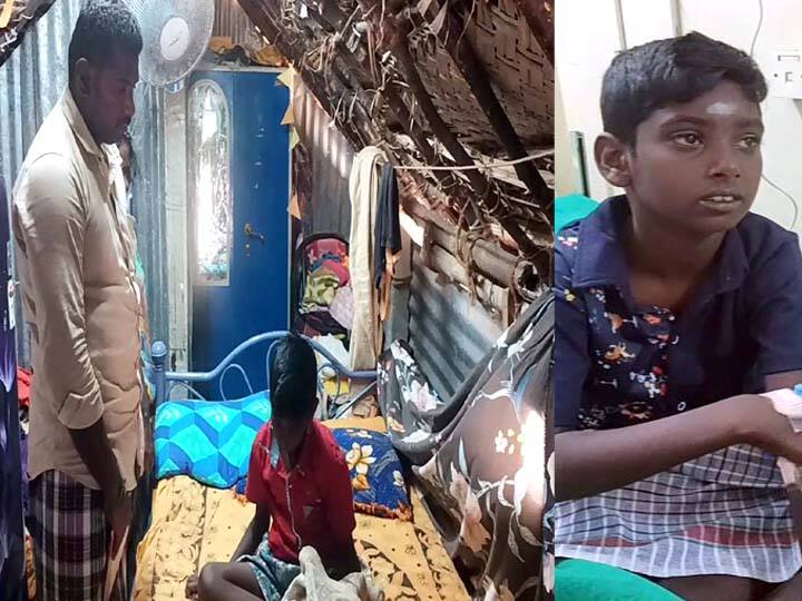 Dindigul: Dindigul boy suffering from a strange disease can save his life only with a liver transplant TNN திண்டுக்கல் : ‘விநோத நோயால் பாதிக்கப்பட்ட  10 வயது  சிறுவன்’ உயிரை காப்பாற்ற முதல்வருக்கு பெற்றோர் கண்ணீர் மல்க கோரிக்கை..!