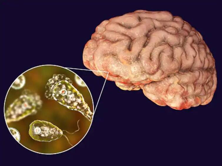 Brain Eating Amoeba First Case Reported in South Korea Naegleria Fowleri 1st Infection Brain Eating Amoeba: உலகை பயமுறுத்தும் புதிய நோய்; மூளையை உண்ணும் அமீபாவிற்கு தென்கொரியாவில் முதல் உயிரிழப்பு..!