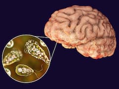 South Korea Registers First Death From 'Brain-Eating Amoeba': Report