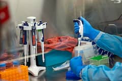 Researchers From India, Israel, US Trying To Develop Drug To Treat Rare 'GNB1 Encephalopathy' Disease