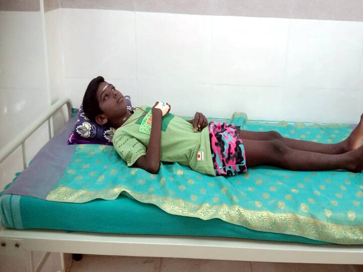 ABP NADU IMPACT: விநோத நோயால் பாதிக்கப்பட்ட திண்டுக்கல் சிறுவனுக்கு சிகிச்சை அளிக்க சுகாதாரத்துறை அமைச்சர் உத்தரவு