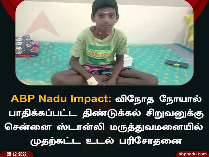 abp impact : Health Minister orders to treat Dindigul boy suffering from strange disease. ABP NADU IMPACT: விநோத நோயால் பாதிக்கப்பட்ட திண்டுக்கல் சிறுவனுக்கு சிகிச்சை அளிக்க சுகாதாரத்துறை அமைச்சர் உத்தரவு