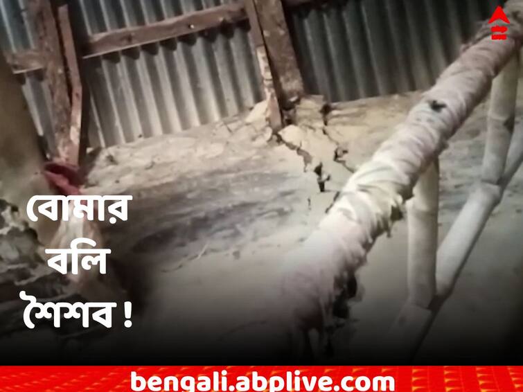 Birbhum : The boy who was injured in Margram bomb blast died in hospital Birbhum : বল ভেবে হাত দেয় বোমায় ! জখম বালকের মৃত্যু হাসপাতালে