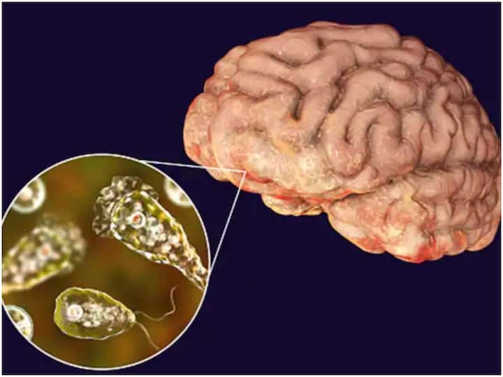 Brain Eating Amoeba - how does it enter the body? మనకు తెలియకుండానే మెదడులో చేరే అమీబా, బ్రెయిన్ తినేస్తుంది - ఇది ఎలా శరీరంలో చేరుతుంది?