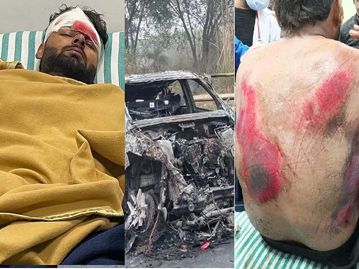 Rishabh Pant Car Accident leg fracture injury roorkee dehradun updates Rishabh Pant Car Accident: कार एक्सीडेंट की वजह से ऋषभ पंत के पैर पर गंभीर चोट, जानें और कहां-कहां हुई इंजरी