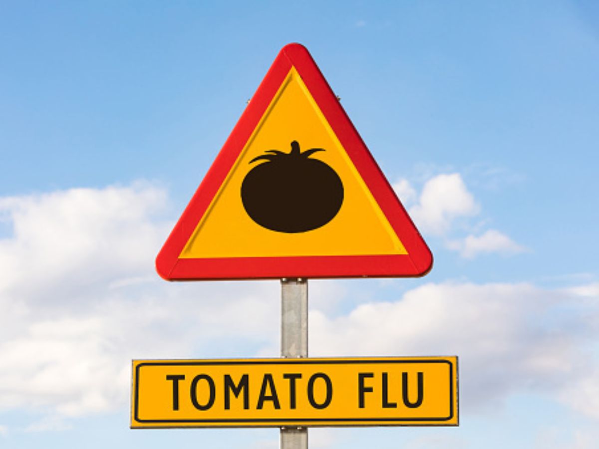 Tomato Flu (Photo: Getty)