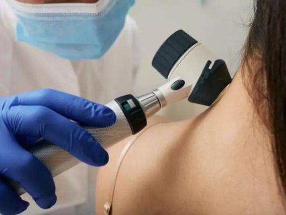 Skin Cancer: Never ignore these symptoms appearing in the body, 'skin cancer' may occur Skin Cancer: શરીરમાં દેખાતા આ લક્ષણોને ક્યારેય અવગણશો નહીં, થઈ શકે છે 'સ્કિન કેન્સર'