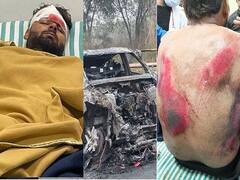 Pant Accident: રુવાંડા ઉભા કરી દેનારી તસવીરો આવી સામે, ઋષભ પંતની કારનો અકસ્માત, માથા-પીઠ પર ઇજા.....