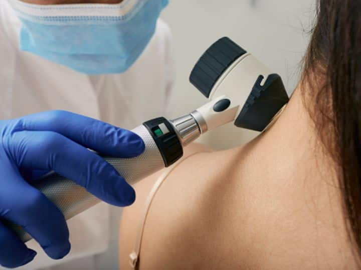 How To Recognise Skin Cancer Types Symptoms Treatment Protection Health News Skin Cancer: शरीर में दिखने वाले इन लक्षणों को कभी न करें नजरअंदाज, हो सकता है 'स्किन कैंसर'