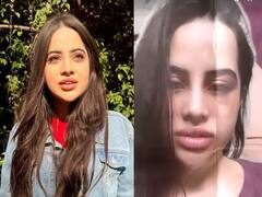 Urfi Javed: सुजलेला चेहरा, डोळ्या खाली काळा डाग; फोटो शेअर करुन उर्फी जावेद म्हणाली, 'मला कोणी मारलं नाही, हे...'