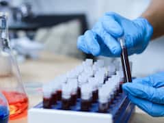 Transition Point Between Chronic To Aggressive Blood Cancer, How It Can Progress As Disease In Some: Study