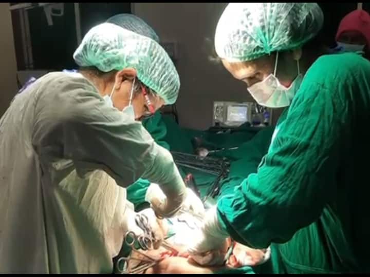 successful operation of uterus after two decades in Bhind district hospital woman was suffering from uterine lump ANN Bhind: भिंड में दो दशक बाद गर्भाशय का सफल ऑपरेशन, सीमित संसाधन के बावजूद डॉक्टरों का कमाल