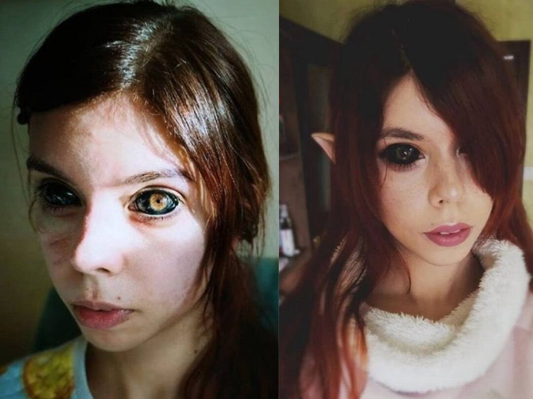 horror tattoo bungle has left a young woman blind Shocking News: ਟੈਟੂ ਨੇ ਔਰਤ ਨੂੰ ਬਣਾਇਆ ਅੰਨ੍ਹਾ, ਬਦਲਣੀ ਪਈ ਅੱਖ