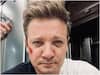 Jeremy Renner Health Update: 'एवेंजर्स' फेम हॉलीवुड एक्टर जेरेमी रेनर की हुई सर्जरी, बर्फ हटाते समय हो गए थे हादसे का शिकार