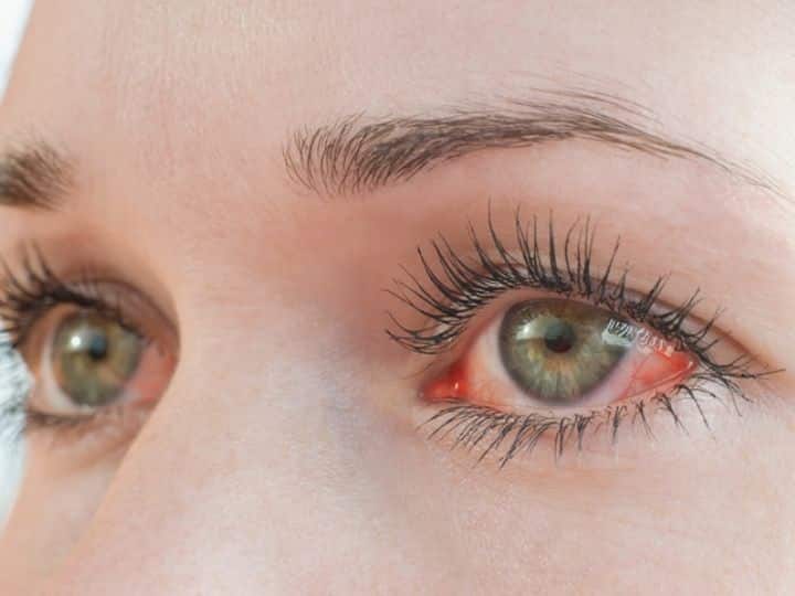 Tips to prevent eye irritation while working on your laptop Eye Care Tips: આંખોની રોશની વધારવા અપનાવો આ ઘરેલુ ટિપ્સ, નહી આવે ચશ્મા