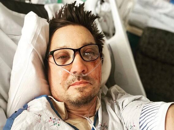 Jeremy Renner shares hospital bed photo of bruised face after scary snowplow accident અકસ્માત બાદ Jeremy Rennerએ હોસ્પિટલના બેડ પરથી શેર કરી સેલ્ફી, એવેન્જર્સ કો-સ્ટાર્સે કર્યું રિએક્ટ