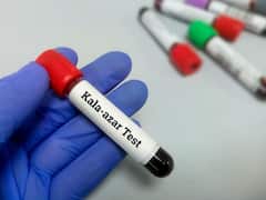 भारत से 'कालाजार रोग' का खात्मा! 2007 से मामलों में आई 98.7 प्रतिशत की कमी