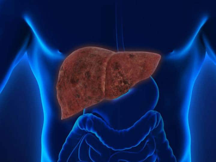 Can liver damage be reversed Know all about liver damage Damage Liver Symptoms: खराब लिवर क्या दोबारा से हो सकता है ठीक? जानिए इस पर डॉक्टर्स क्या कहते हैं?