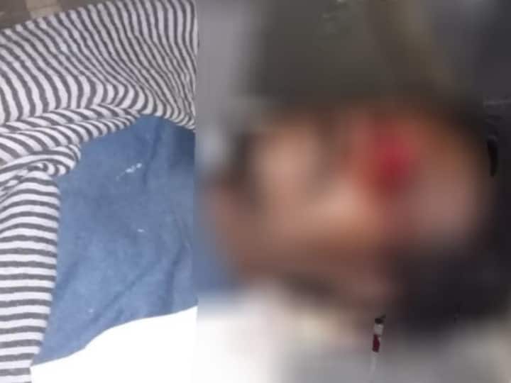 MP News Sagar District Hospital Rats Eat Eye of Dead Body in mortuary carelessness of Health Department ANN Sagar: इस लापरवाही का जिम्मेदार कौन! मोर्चुरी में रखे शव की आंख कुतरकर खा गए चूहे, परिजनों से बात छुपाई