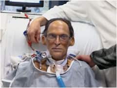 Heartless Man: ఇతడు గుండె లేకుండా నెల రోజులు జీవించగలిగాడు, ఇంతకీ ఎలా?