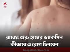 শুরু হল হাম, রুবেলার প্রতিষেধক দেওয়া, কীভাবে চিনবেন এই রোগ