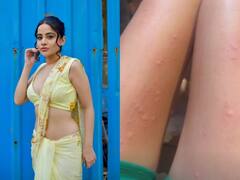 क्या!! उर्फी जावेद को कपड़ों से है एलर्जी, कहा- ‘इसीलिए नहीं पहनती हूं’, देखें उनका हाल