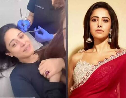 Nushrratt Bharuccha Meets Accident At Chhori 2 Set Share Video From Hospital Actress Injured : સેટ પર જ ઘાયલ થઈ અભિનેત્રી, આંખના ભાગે લેવા પડ્યા ટાંકા