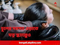 শীতের মরসুমে চুলের সমস্যা এড়াতে যত্ন নিন স্ক্যাল্পেরও, কী কী করবেন?