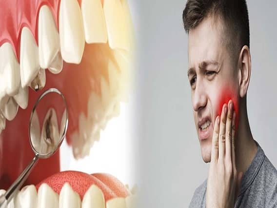 how-to-cure-toothache-in-home-dant-ke-dard-ka-gharelu-upay Dental care: દાંતના દુઃખાવાને હળવાશથી ન લો, સડો પહોંચાડી શકે છે નુકસાન, અજમાવો આ ત્રણ ઘરગથ્થુ ઉપચાર